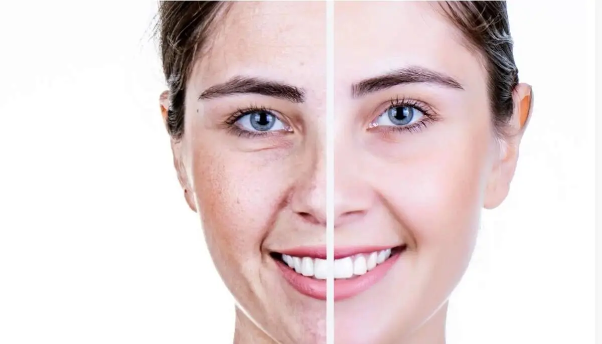 برای مقابله با پیری پوست، این ۴ خوراکی را حتما بخورید!