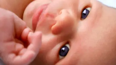 علت‌های اصلی زردی چشم در نوزادان چیست؟