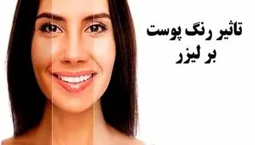 تغییر رنگ پوست با لیزر