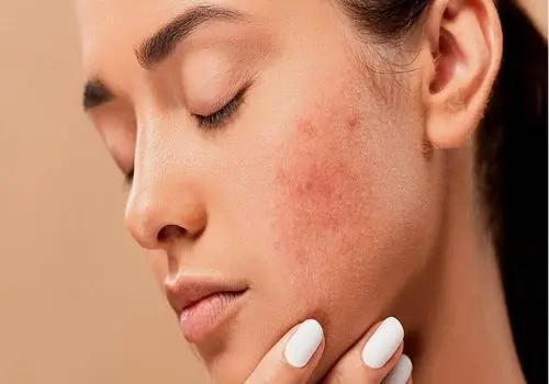 صبحانه‌ای لوکس با مارمالاد شاتوت؛ رنگ خیره‌کننده، طعمی فراموش‌نشدنی