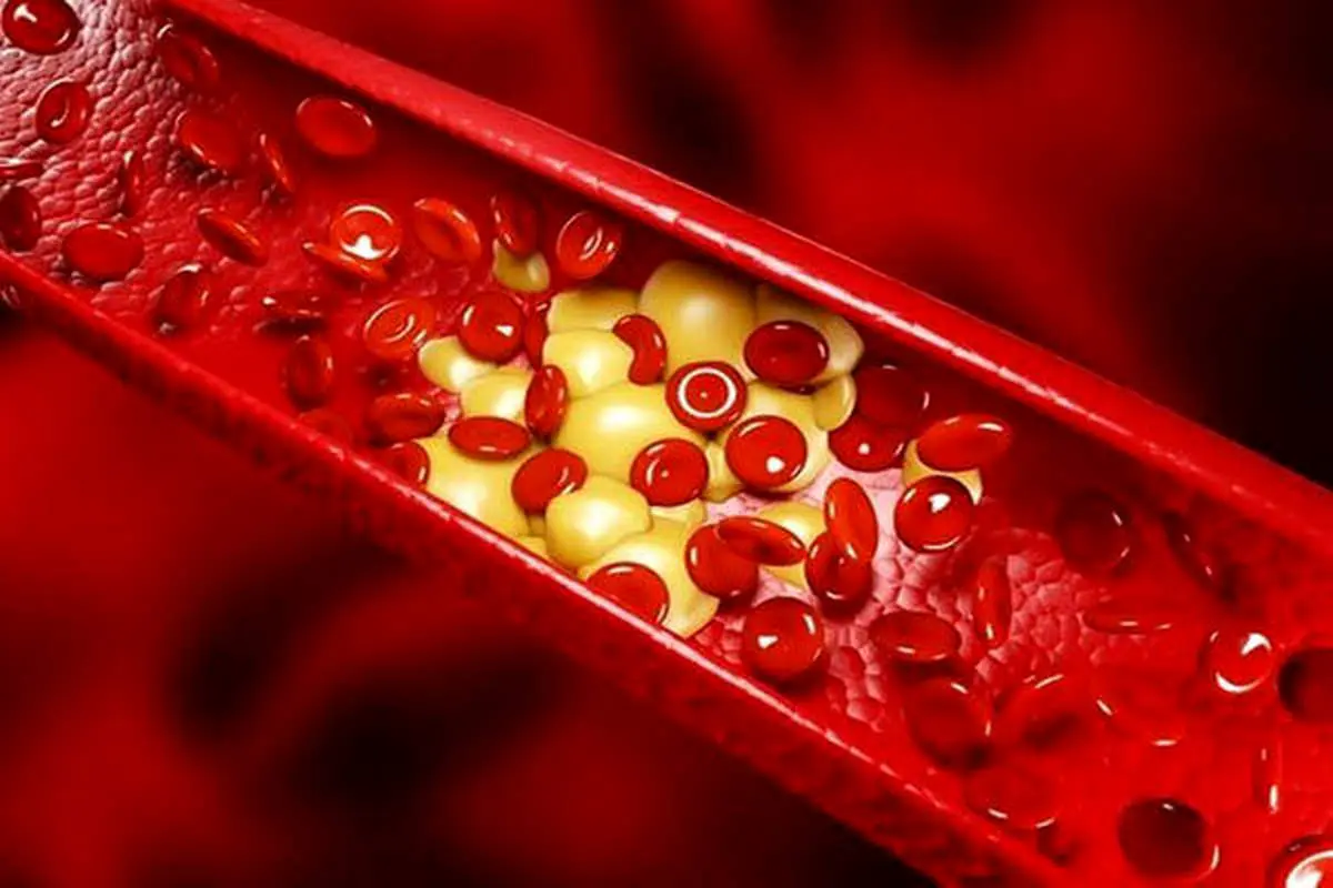 گیاهان دارویی، دشمن طبیعی چربی خون بالا
