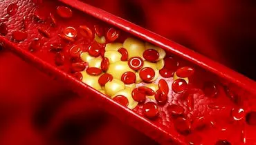 گیاهان دارویی، دشمن طبیعی چربی خون بالا
