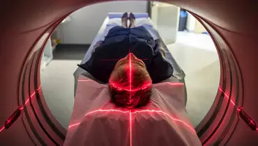 خوانش افکار با هوش مصنوعی؛ گامی نوین در تحلیل اسکن‌های مغزی