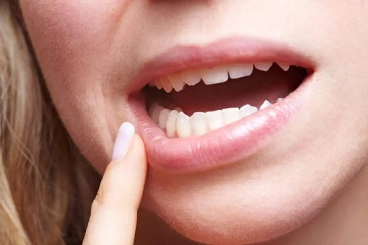 دلیل درد لثه و فک پایین چیست؟
