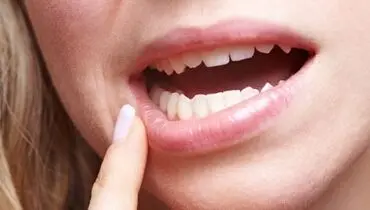 دلیل درد لثه و فک پایین چیست؟
