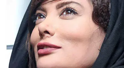 آیا این همان نگار است؟ راز تغییر چهره‌ی ستاره سینما