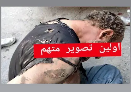 مسواک برقی بهتر است یا معمولی؟