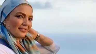 پاسخ شهرزاد عبدالمجید به سوالات تکراری درباره جراحی زیبایی/ویدیو 