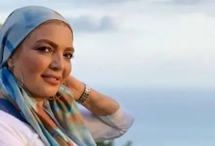 پاسخ شهرزاد عبدالمجید به سوالات تکراری درباره جراحی زیبایی/ویدیو 