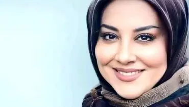 تغییرچهره آشا محرابی قبل و بعد از عمل های زیبایی+عکس