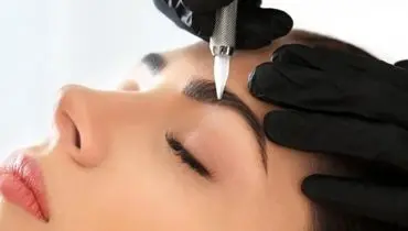 مراقبت بعد از ریموو ابرو 
