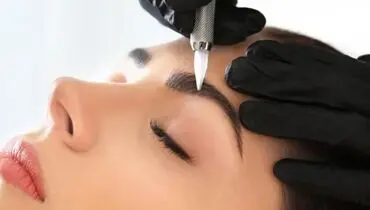 مراقبت بعد از ریموو ابرو 
