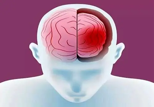 شکلات تلخ؛ شیرینی سالم برای پاکسازی بدن

