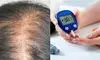 دیابت با ریزش مو چه ارتباطی دارد؟