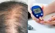 دیابت با ریزش مو چه ارتباطی دارد؟