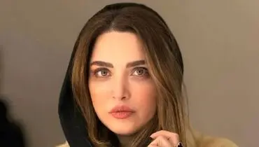 تغییر چهره بهنوش طباطبایی در گذر زمان
