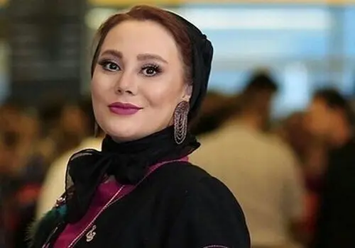 چهره متفاوت بازیگر محبوب «زیر آسمان شهر» خبرساز شد!
