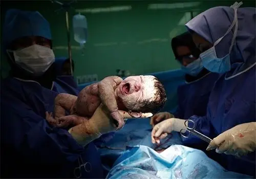 بسته خبری صبحگاهی پارسینه؛ از اعزام نخستین گروه عوامل حج تمتع ۱۴۰۴ به عربستان تا سهم ۵۵ درصدی سزارین از زایمان‌ها 