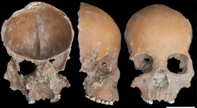 جمجمههای ۵ هزار ساله به کاسه تبدیل شدند +عکس