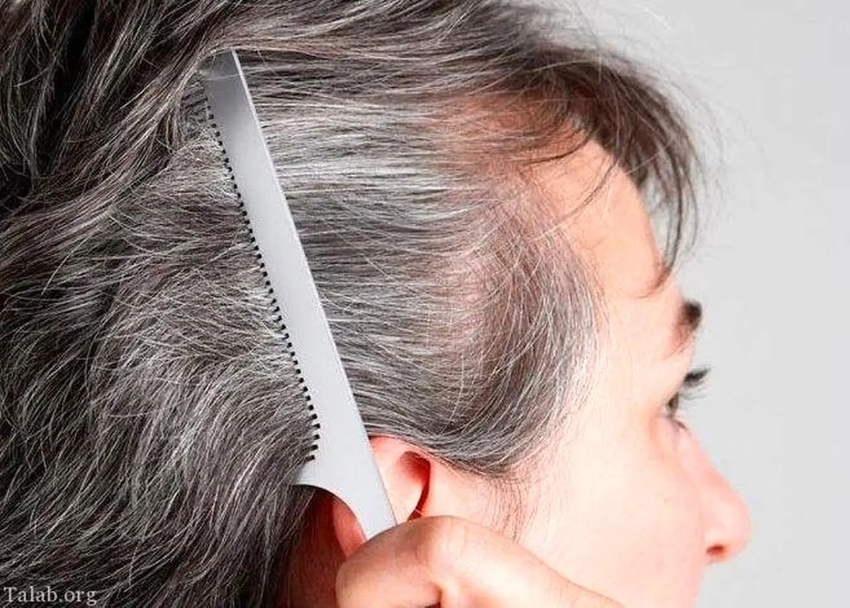 شش راهکار علمی برای کند کردن روند سفیدی مو

