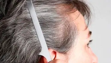 شش راهکار علمی برای کند کردن روند سفیدی مو

