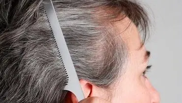 شش راهکار علمی برای کند کردن روند سفیدی مو

