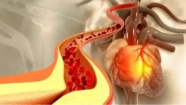 این ادویه دشمن سرسخت کلسترول خون است!