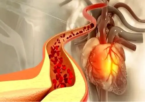 فکرش را هم نمی کنید این گیاه ضدکلسترول، ضد دیابت، ضدچاقی و پاک کننده کبد باشد
