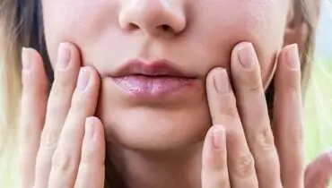 احتمال زوال عقل با ابتلا به تبخال؟