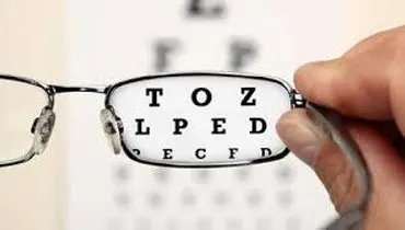 نمره چشم چیست؟
