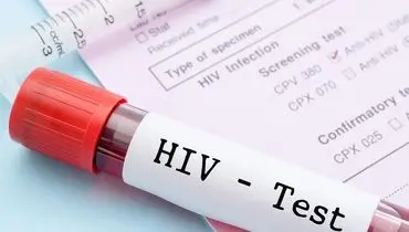 HIV اگر زود تشخیص داده شود؛ پایان زندگی نیست