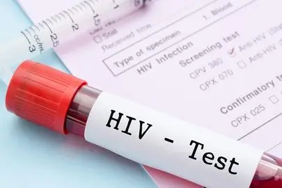 HIV اگر زود تشخیص داده شود؛ پایان زندگی نیست