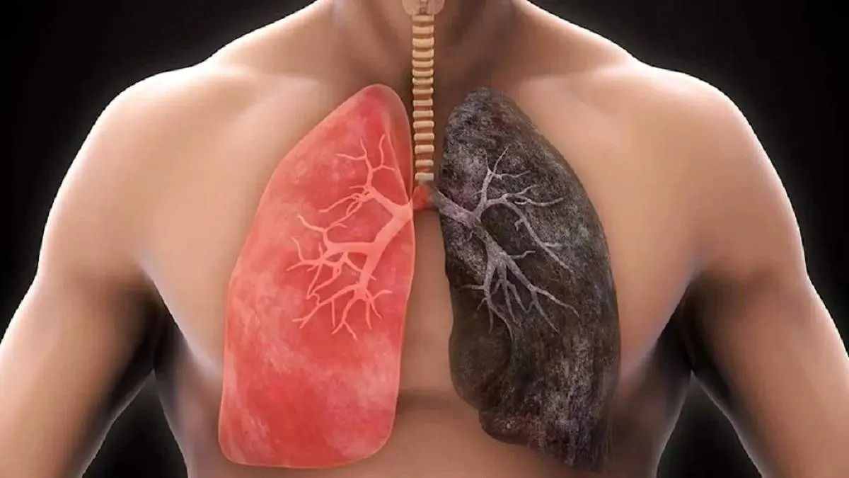 آیا بخور برای سلامت ریه خوب است؟
