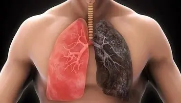 آیا بخور برای سلامت ریه خوب است؟
