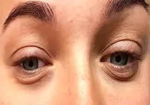 فرق بین سیر خام و سیر پخته
