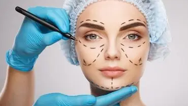 هزینه جراحی‌های زیبایی عجیب؛ زیبایی گوش ۲۲ میلیون، افزایش قد ۱۰۰ هزار دلار!