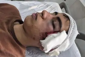 ضرب‌وشتم دانش‌آموز بمی با دسته صندلی؛ آموزش‌وپرورش واکنش نشان داد