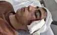 ضرب‌وشتم دانش‌آموز بمی با دسته صندلی؛ آموزش‌وپرورش واکنش نشان داد