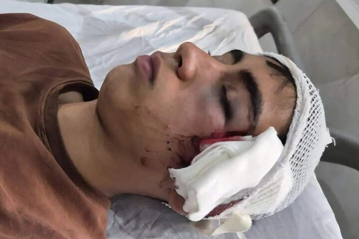 ضرب‌وشتم دانش‌آموز بمی با دسته صندلی؛ آموزش‌وپرورش واکنش نشان داد