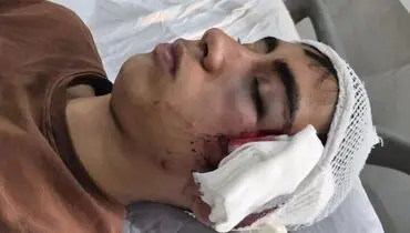 ضرب‌وشتم دانش‌آموز بمی با دسته صندلی؛ آموزش‌وپرورش واکنش نشان داد