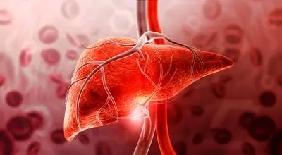پیش‌بینی بیماری شدید کبدی با یک آزمایش خون ساده تا ۱۰ سال زودتر