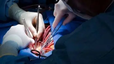 انجام عمل جراحی نادر قلب (TAVI) در بیمارستان گاندی+فیلم