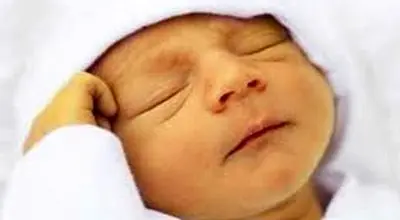 زردی نوزاد تا چند روزگی خطرناک است؟