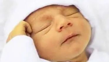  زردی نوزاد تا چند روزگی خطرناک است؟