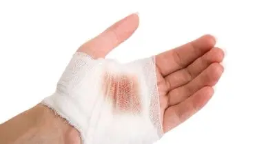 آموزش پانسمان اضطراری در شرایط بحرانی/اینفوگرافی 