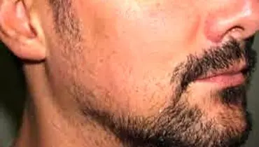 عوامل مؤثر بر رشد ریش
