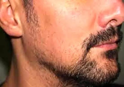 عوامل مؤثر بر رشد ریش
