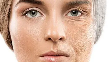 این علامت در پوست یعنی قند خون شما بسیار بالا رفته است
