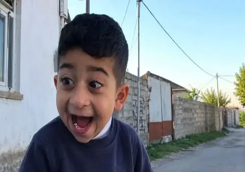 بعد از ۹ سال چهره «کچلیک» را ببینید؛ تغییر باورنکردنی!