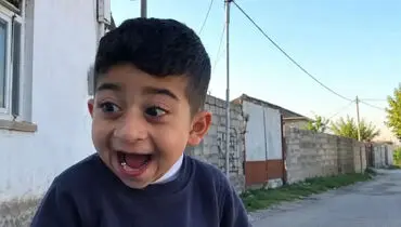 بعد از ۹ سال چهره «کچلیک» را ببینید؛ تغییر باورنکردنی!